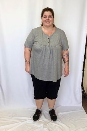 Patient Transformation Stories: Holly Lost 65 Pounds the First 6 Months & is Going Strong! - Before
