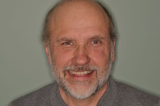 Dental Implants: Case 43 - Improved smile after implant and crown