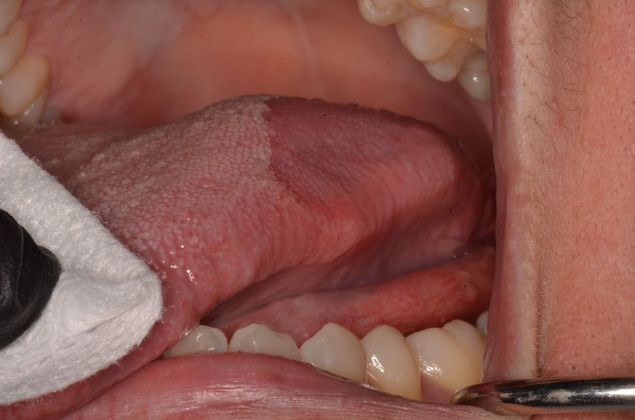 Dental Pathology Cases