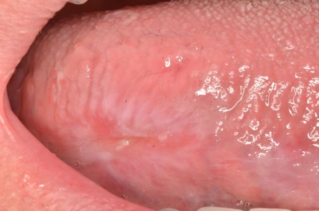 Dental Pathology Case 3 - Before