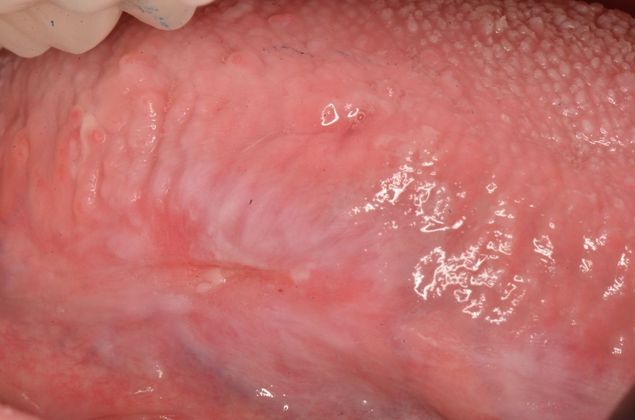 Dental Pathology Case 3 - After