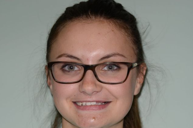 Composite Bonding: Case 7 - Before