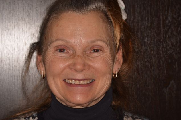 Porcelain Veneers: Case 24 - Before