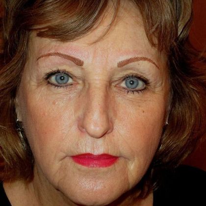 Permanent MakeUp Case 31 - After