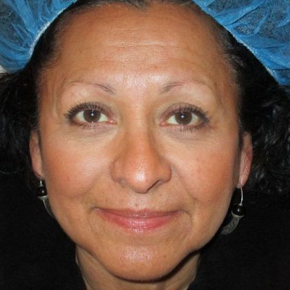 Permanent MakeUp Case 38 - Before