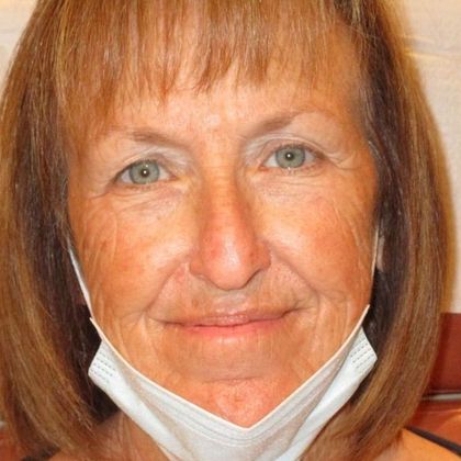 Permanent MakeUp Case 39 - Before