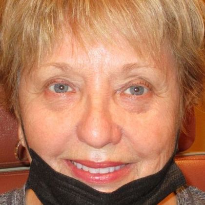 Permanent MakeUp Case 40 - Before