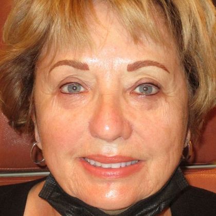 Permanent MakeUp Case 40 - After