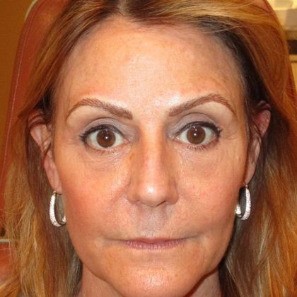 Permanent MakeUp PMU Before and After - After