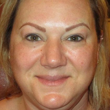 Permanent MakeUp Case 42 - After