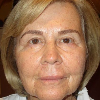 Permanent MakeUp Before and After - After