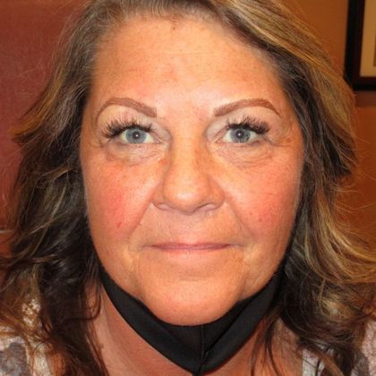 Permanent MakeUp Case 43 - After