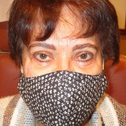 Permanent MakeUp Case 44 - After