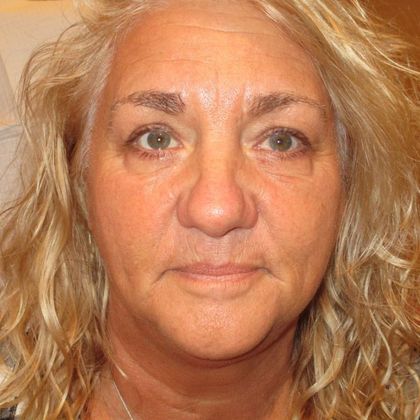 Permanent MakeUp Case 45 - Before