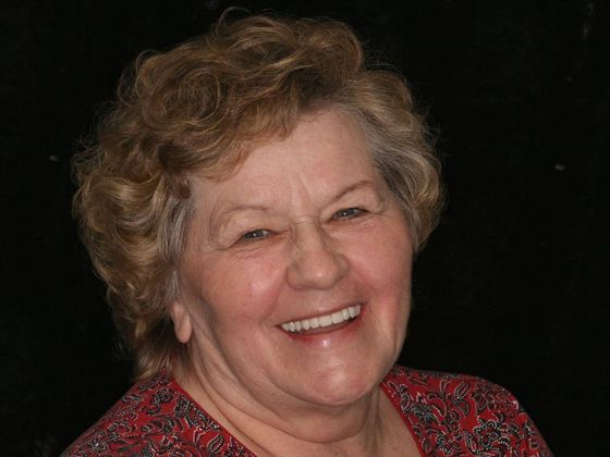 All-on-4/ Full Mouth Dental Implants / Teeth in a Day: Case 1-WG- Upper and lower All-on-4 bridges - After