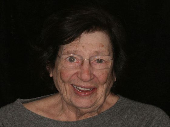 All-on-4/ Full Mouth Dental Implants / Teeth in a Day: Case 7-BB- Upper and lower All-on-4 bridges - After