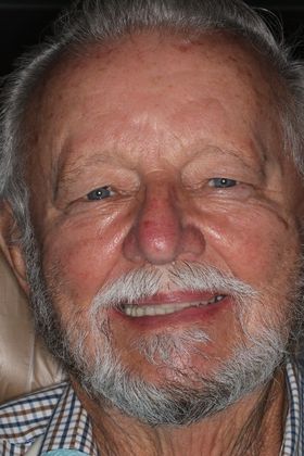 Dental Crowns Case 4 - After