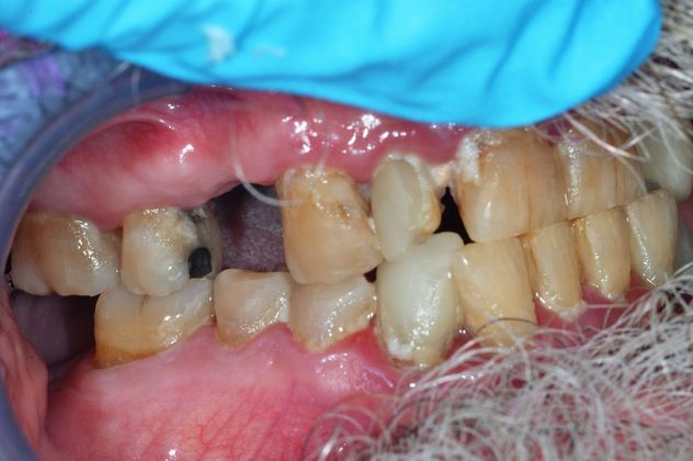 Teeth In A Day Case 6 - Before