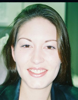 Gum Lift Case 6 - After