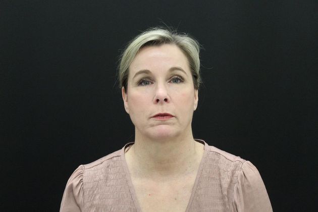 Face & Neck Lifts: Case 11 - Before