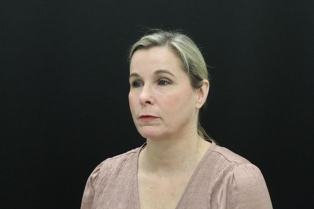 Face & Neck Lifts: Case 11 - After