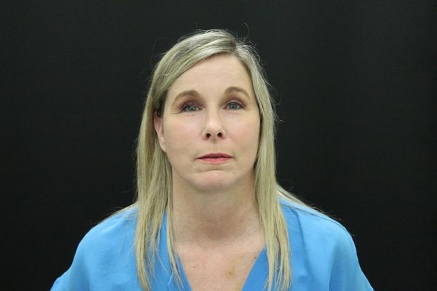 Face & Neck Lifts: Case 11 - Before