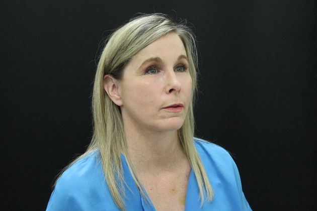 Face & Neck Lifts: Case 11 - After