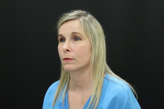 Face & Neck Lifts: Case 11 - After