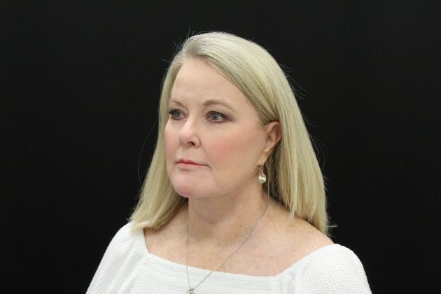 Face & Neck Lifts: Case 10 - After