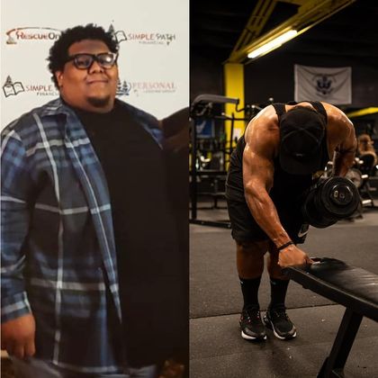 Gastric Sleeve - Click Here to See More! : Anthony L - Before