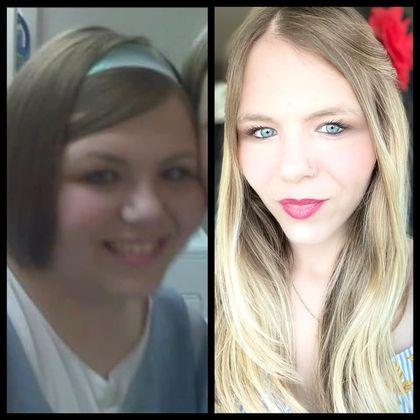 Gastric Sleeve - Click Here to See More! : Elizabeth H - Before