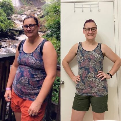 Gastric Sleeve - Click Here to See More! : Kate M - Before