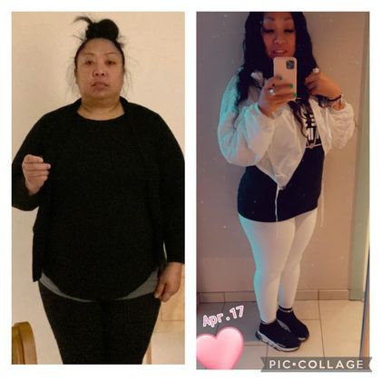 Gastric Sleeve - Click Here to See More! : Rachell D - Before