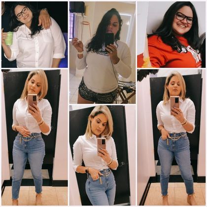 Gastric Sleeve - Click Here to See More! : Xiomara - Before