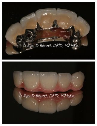Trauma Cases: Case 1 - Before
