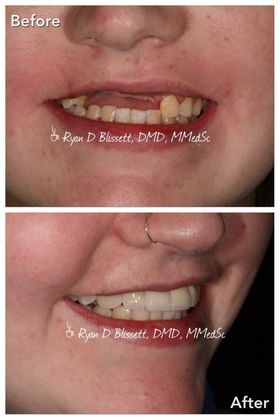 Trauma Cases: Case 1 - After