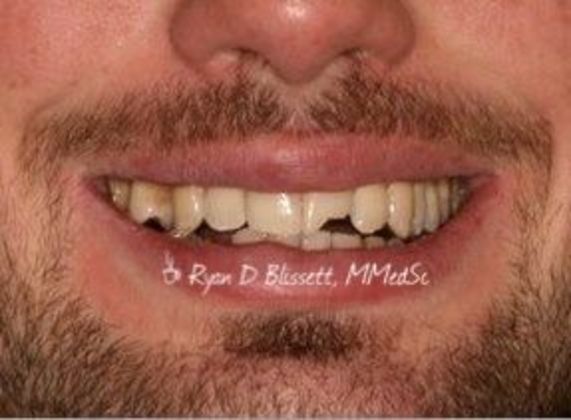 Trauma Cases: Case 2 - Before