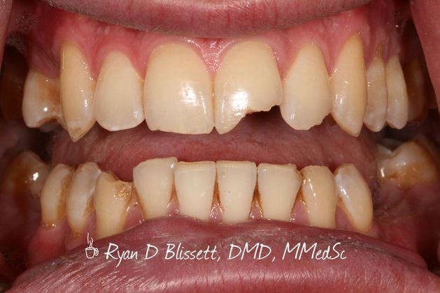 Trauma Cases: Case 2 - Before