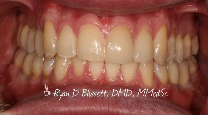 Trauma Cases: Case 2 - After