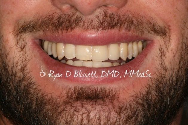 Trauma Cases: Case 2 - After