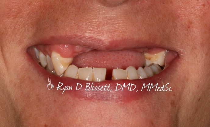 Trauma Cases Case 3 - Before