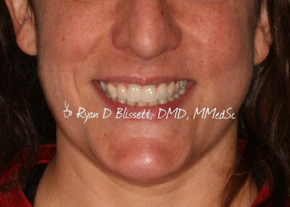 Trauma Cases Case 3 - After