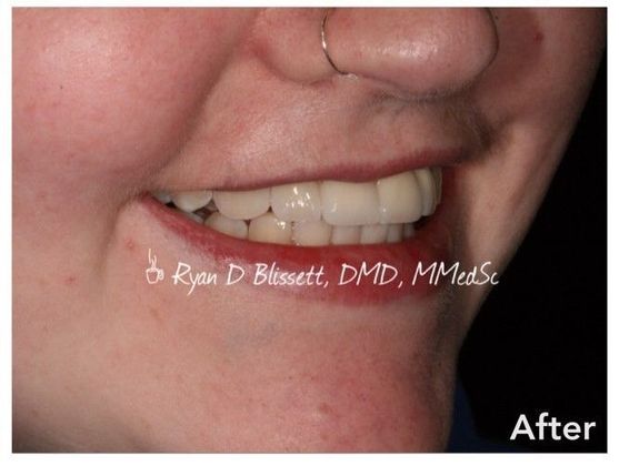 Trauma Cases: Case 1 - After