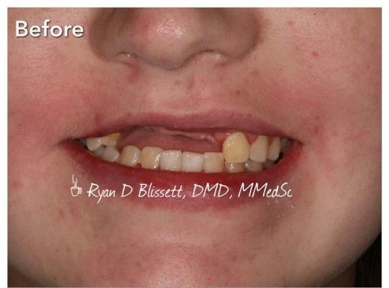 Trauma Cases: Case 1 - Before