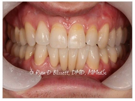 Trauma Cases: Case 4 - After