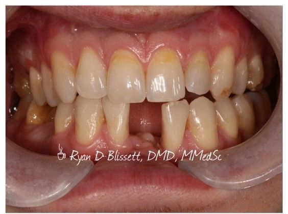 Trauma Cases: Case 4 - Before