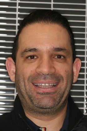 Porcelain Veneers Upper and lower veneers for smile makeover - Before