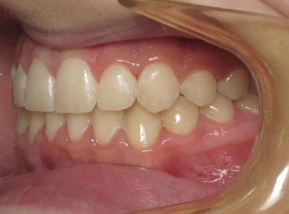 Karis: Karis - After