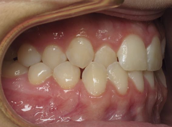 Karis: Karis - Before