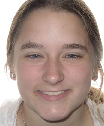 Karis: Karis - After